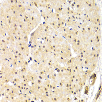 Anti-TERF1 Antibody (CAB0137)