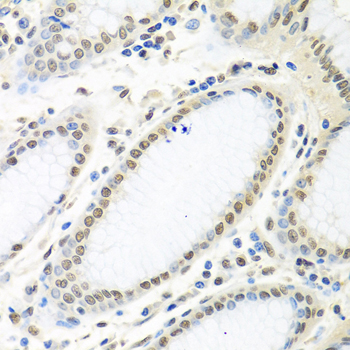 Anti-HuR / ELAVL1 Antibody [KO Validated] (CAB6089)