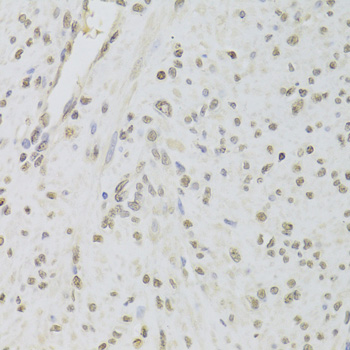 Anti-RUVBL1 Antibody (CAB5723)