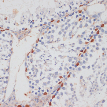 Anti-HTATSF1 Antibody (CAB14542)