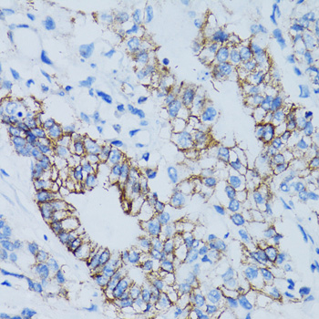 Anti-LGALS8 Antibody (CAB6646)