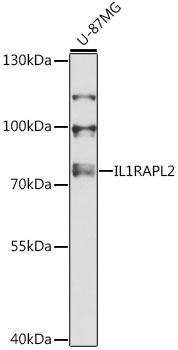 Anti-IL-1RAPL2 Antibody (CAB13084)