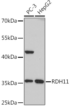 Anti-RDH11 Antibody (CAB18454)