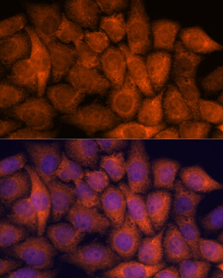 Anti-RPAP3 Antibody (CAB15239)