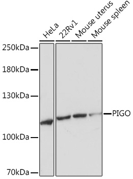 Anti-PIGO Antibody (CAB18670)