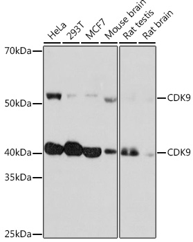 Anti-CDK9 Antibody