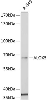 Anti-ALOX5 Antibody (CAB2158)