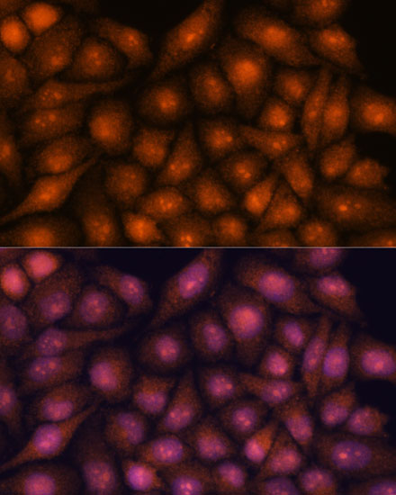 Anti-DDX31 Antibody (CAB15892)