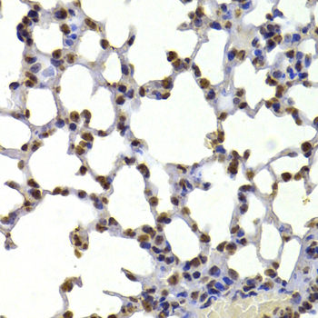 Anti-CBX5 Antibody [KO Validated] (CAB12577)