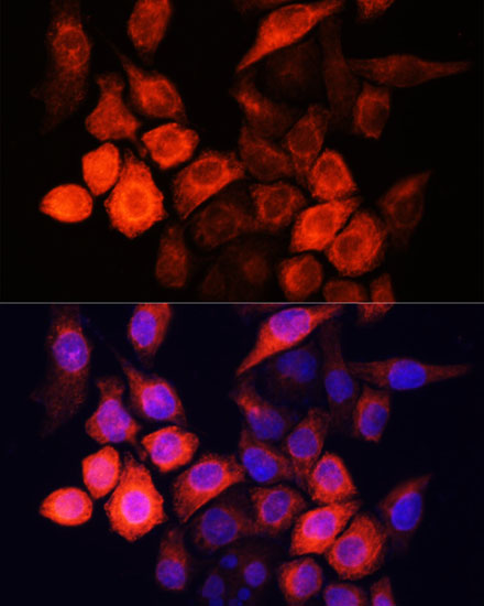 Anti-SHH Antibody (CAB12503)