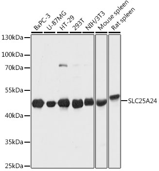 Anti-SLC25A24 Antibody (CAB12138)