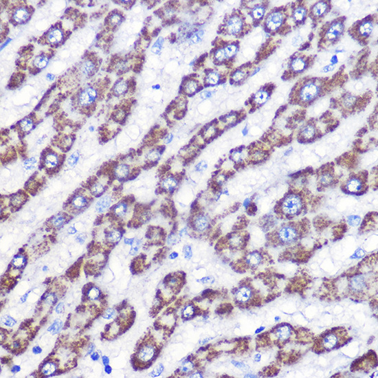 Anti-UCP3 Antibody (CAB16995)