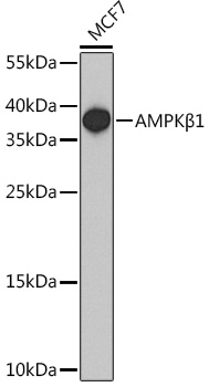 Anti-AMPKBeta1 Antibody (CAB15708)