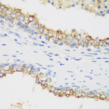 Anti-PTEN Antibody (CAB11189)