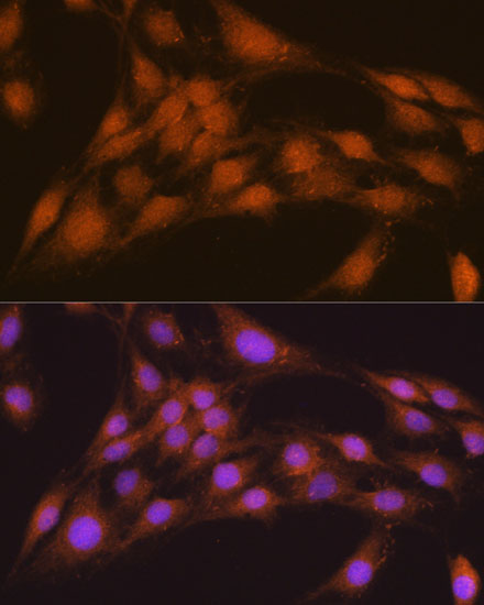 Anti-NRBF2 Antibody (CAB6462)