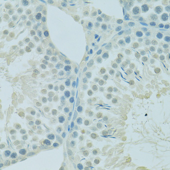 Anti-PSIP1 Antibody (CAB14852)