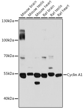 Anti-Cyclin A1 Antibody (CAB14529)