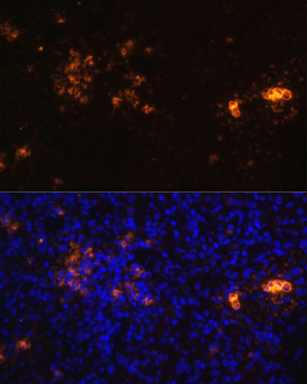 Anti-CD70 Antibody (CAB16809)