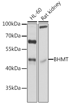 Anti-BHMT Antibody (CAB1216)