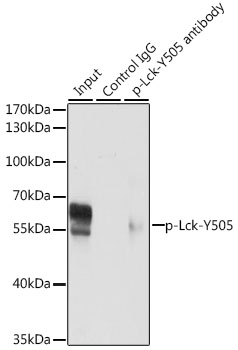 Anti-Phospho-Lck-Y505 Antibody (CABP0285)