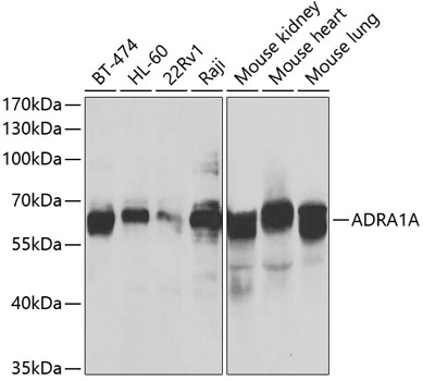 Anti-ADRA1A Antibody (CAB7873)