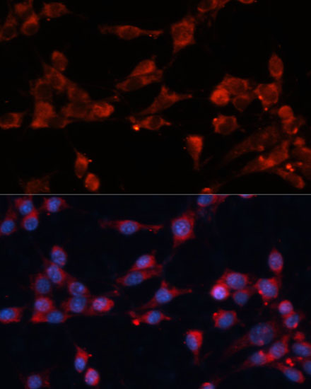 Anti-EIF3B Antibody (CAB10259)