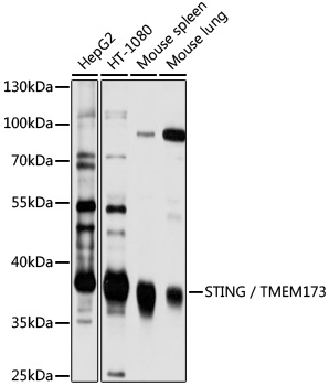 Anti-STING / TMEM173 Antibody (CAB3262)