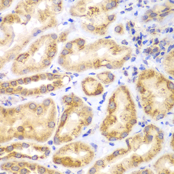 Anti-EYA3 Antibody (CAB7893)