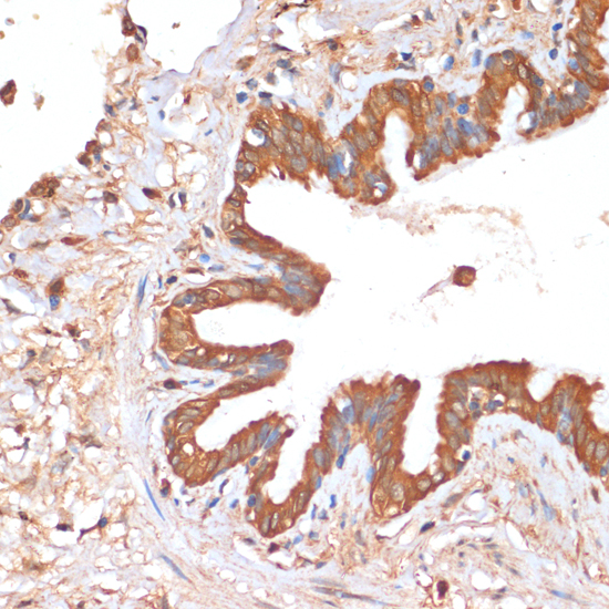 Anti-HHLA2 Antibody (CAB13262)