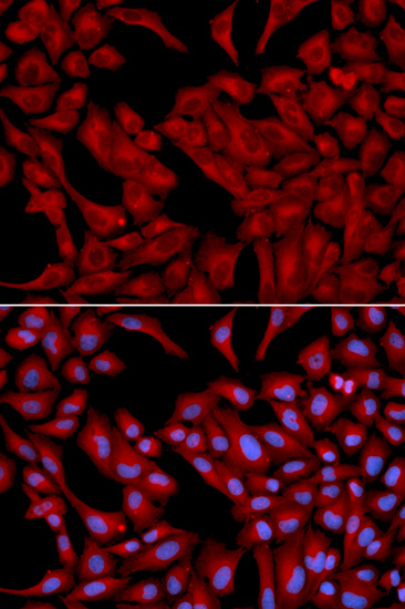 Anti-DCTN2 Antibody (CAB2200)