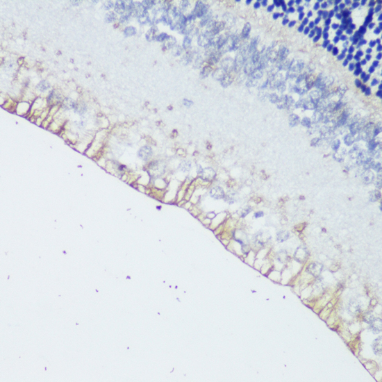 Anti-OPN4 Antibody (CAB16289)