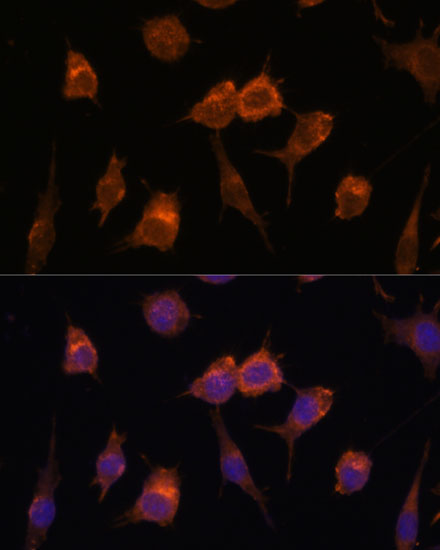 Anti-AVIL Antibody (CAB15785)