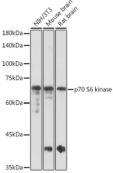 Anti-p70 S6 kinase Antibody (CAB16968)