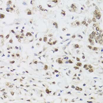 Anti-PPP1CC Antibody [KO Validated] (CAB4035)