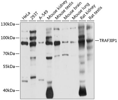 Anti-TRAF3IP1 Polyclonal Antibody (CAB8997)