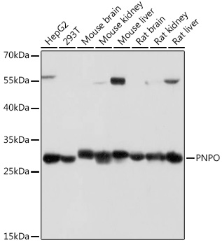 Anti-PNPO Antibody (CAB18495)