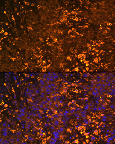 Anti-UGT1A1 Antibody (CAB6186)