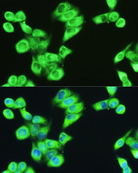 Anti-SERPINE1 Antibody (CAB14758)