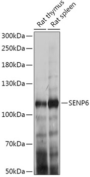 Anti-SENP6 Antibody (CAB17673)