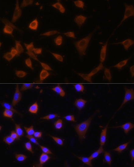 Anti-GANAB Antibody (CAB13851)