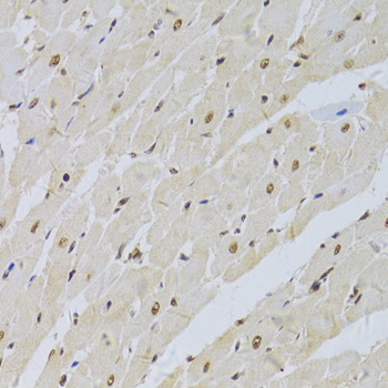 Anti-SNRPA Antibody (CAB6410)