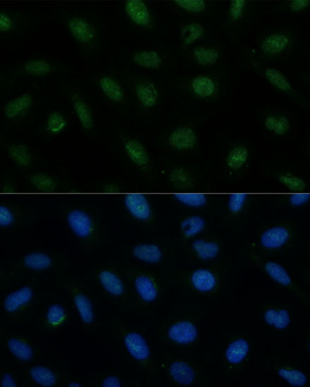 Anti-CENPA Antibody (CAB15995)