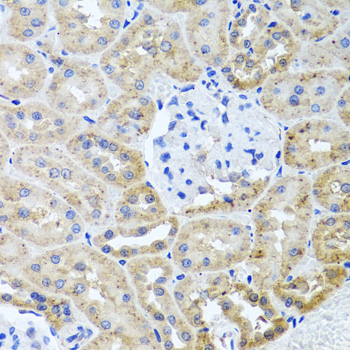 Anti-HDAC6 Antibody (CAB1732)