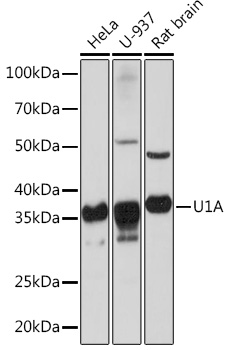 Anti-U1A Antibody (CAB3686)