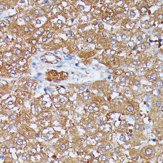 Anti-HDLBP Antibody (CAB6028)