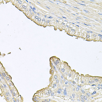 Anti-FABP12 Polyclonal Antibody (CAB9894)