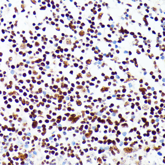 Anti-PML Antibody [KO Validated] (CAB1184)