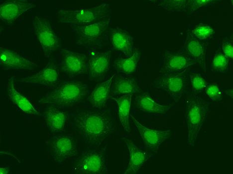 Anti-XPA Antibody [KO Validated] (CAB1626)