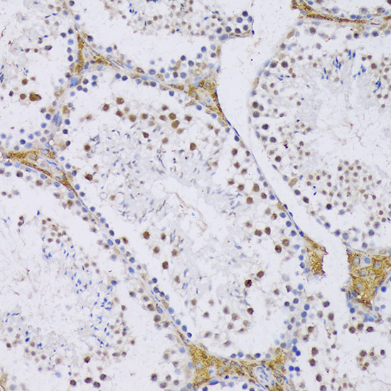 Anti-SRSF3 Antibody (CAB6067)