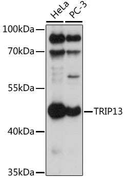 Anti-TRIP13 Antibody (CAB17357)